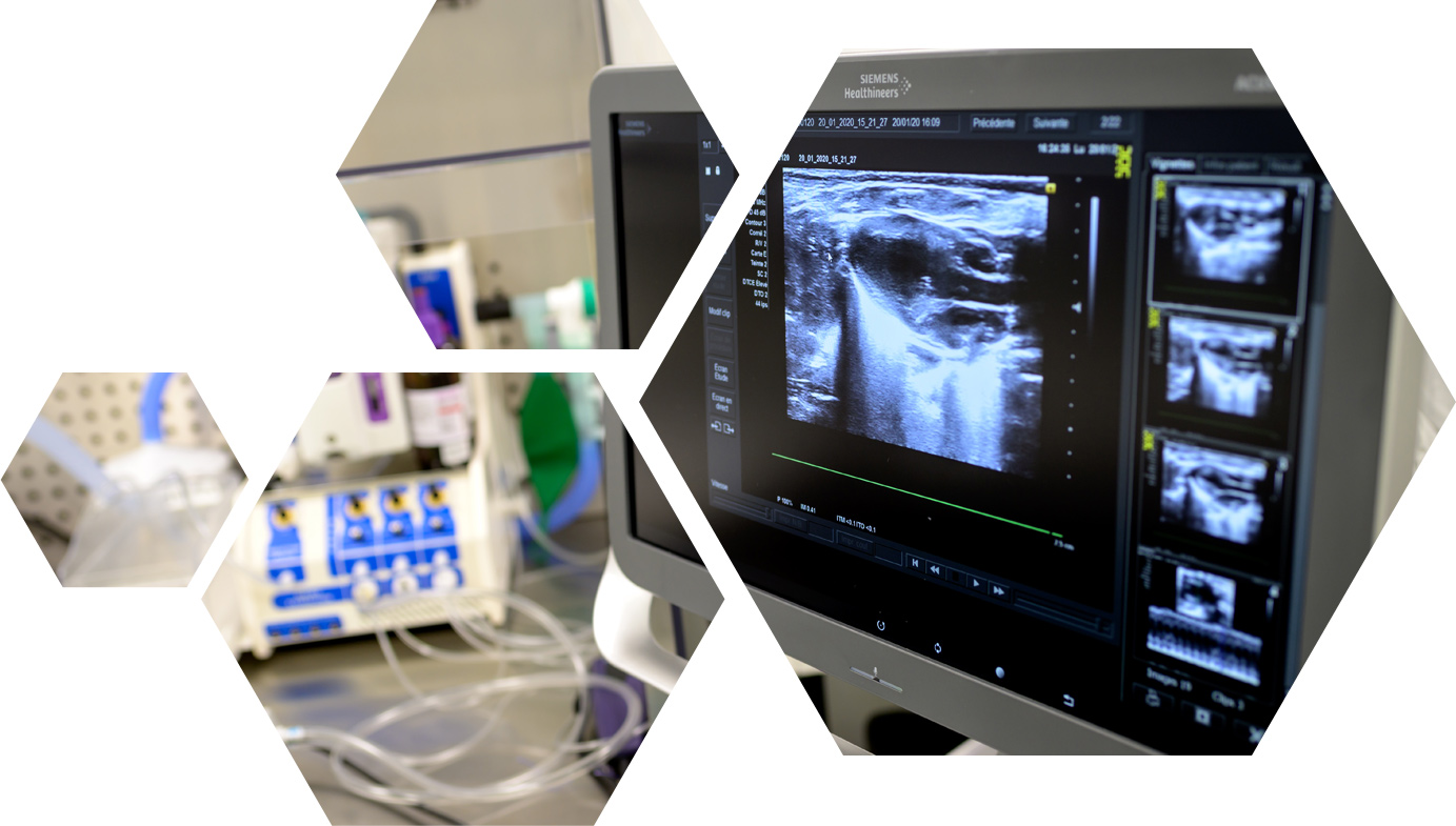 echocardiography in vivo exploration cardiovascular diseases