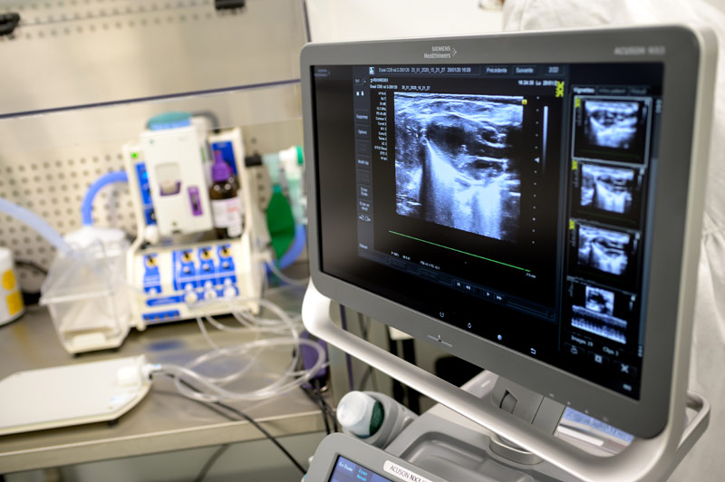 echocardiography